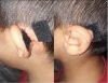 Ear correction.JPG